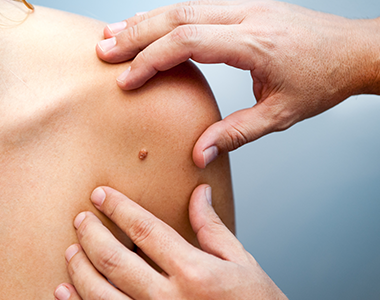 Petits gestes en dermatologie pour les médecins généralistes