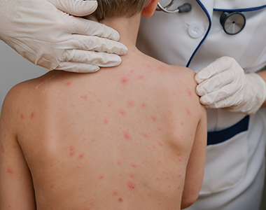 Dermatologie pédiatrique de l'enfant en âge scolaire (Tome 2)