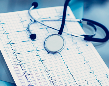 Quand faire un ECG au cabinet du médecin généraliste