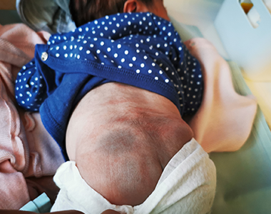 Dermatologie courante de l’enfant de 0 à 3 ans (Tome 1)