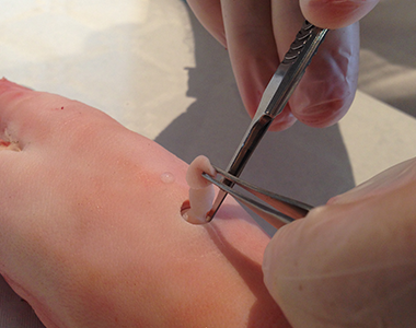 Petits gestes en dermatologie pour les médecins généralistes