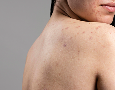 Les assises de la dermatologie : motifs fréquents de consultation en médecine générale