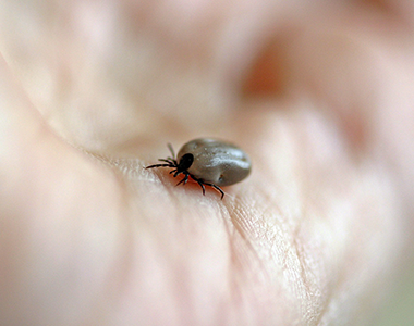 Prévenir et prendre en charge la maladie de Lyme : un enjeu pour limiter l’antibiorésistance