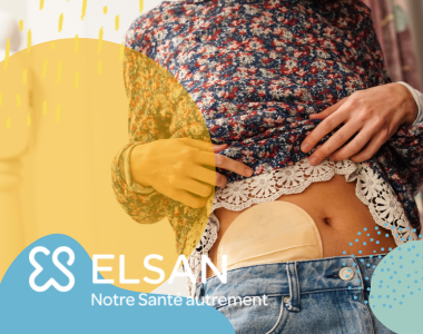 Les stomies en long, en large et en travers !