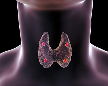 Actualités dans le diagnostic et la prise en charge des dysthyroïdies : les nouvelles recommandations