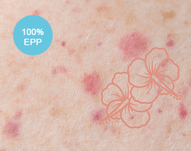 Histoires dermatologiques vécues en consultation : évaluez vos pratiques par des vignettes cliniques