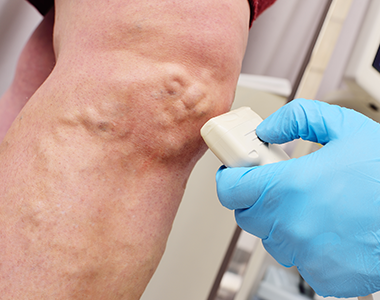 L'échographie : un outil utile pour les urgences rencontrées au cabinet de médecine générale