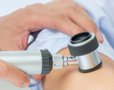 Intérêt de la dermoscopie dans le repérage précoce des cancers cutanés - Niveau 2 (EPP)