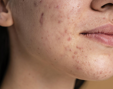 Classe virtuelle : les soirées de la dermato : cas pratiques et ordonnances types - Tome 2 : le visage et le cuir chevelu