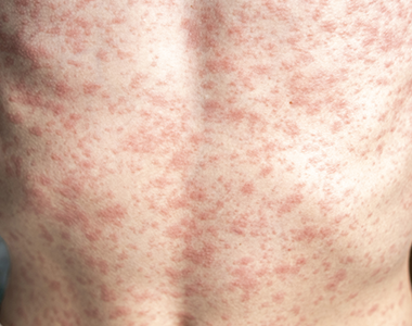 Classe virtuelle : les soirées de la dermato : cas pratiques et ordonnances types - Tome 3 : 10 avis fréquents en téléexpertise