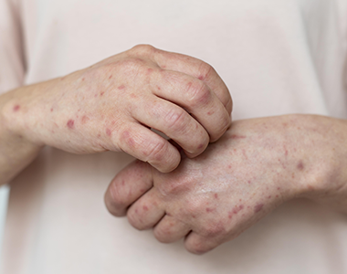 Parcours maladies de peau en médecine générale