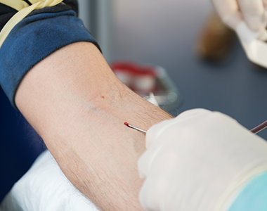 Être acteur de sa maladie chronique : le patient atteint d’hémochromatose