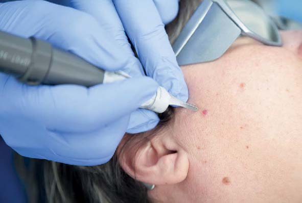 Gestes pratiques en dermatologie