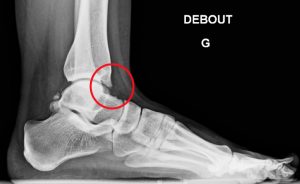figure-1_dr_benoist